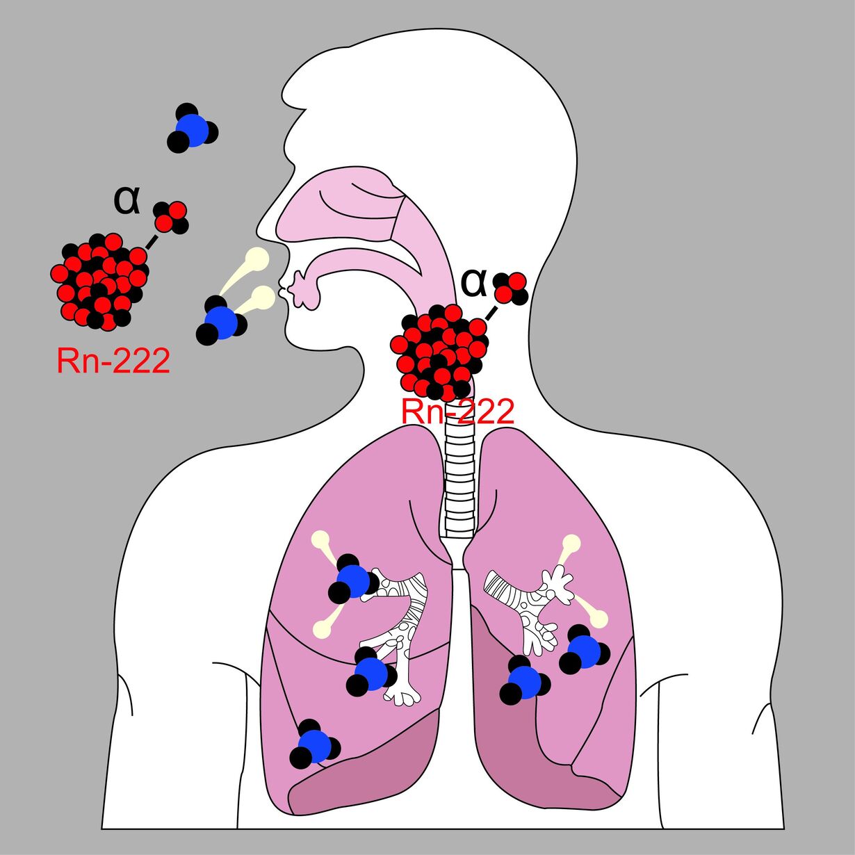 Inhalation Radon